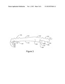 Detachable Foot Rest diagram and image