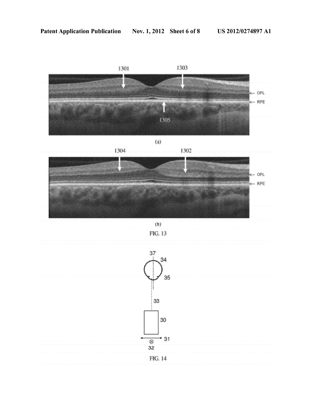 SYSTEMS AND METHODS FOR IMPROVED OPHTHALMIC IMAGING - diagram, schematic, and image 07