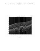 SYSTEMS AND METHODS FOR AUTOMATED CLASSIFICATION OF ABNORMALITIES IN     OPTICAL COHERENCE TOMOGRAPHY IMAGES OF THE EYE diagram and image