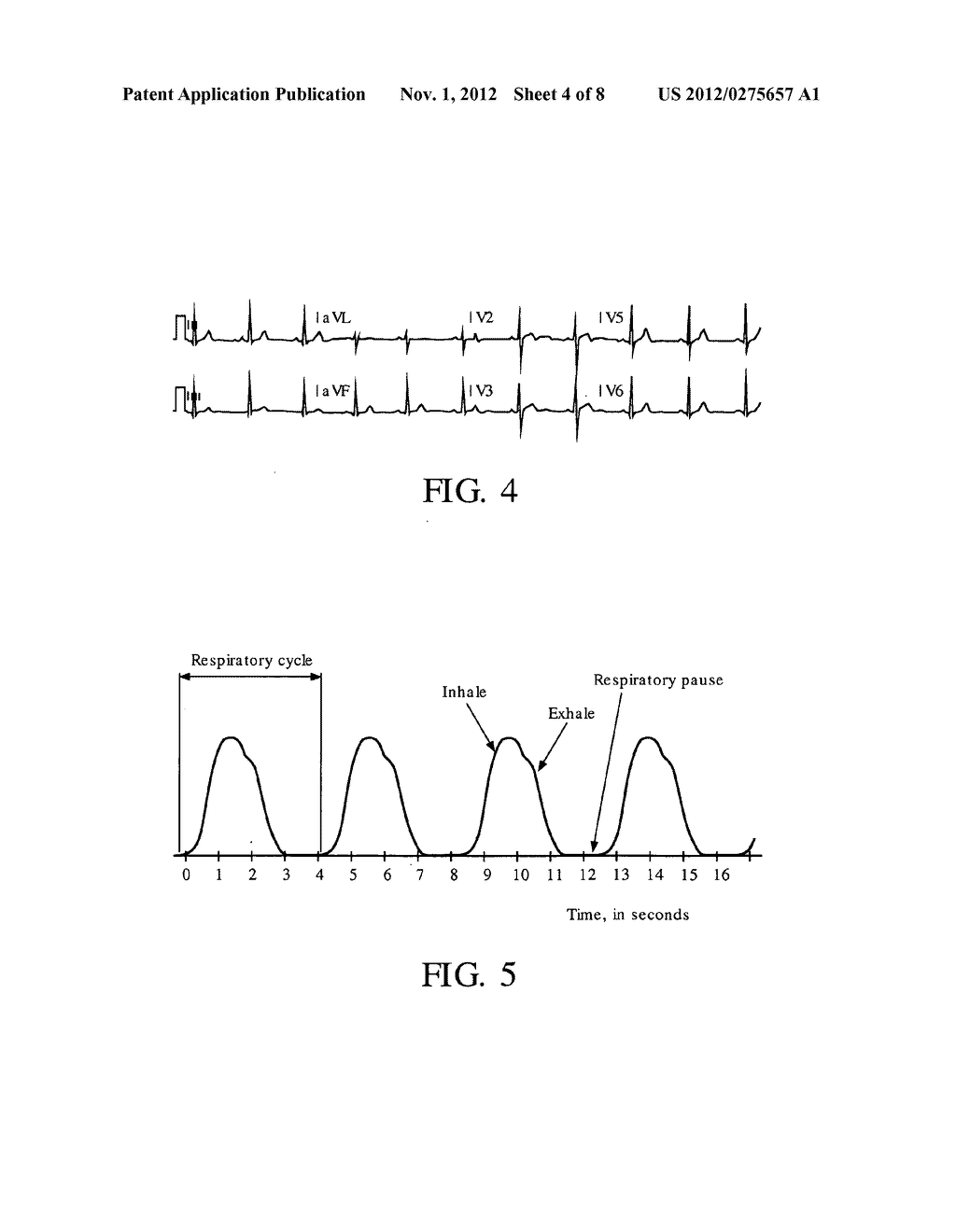 METHOD AND APPARATUS FOR USING TIME OF FLIGHT INFORMATION TO DETECT AND     CORRECT FOR MOTION IN IMAGING SCANS - diagram, schematic, and image 05