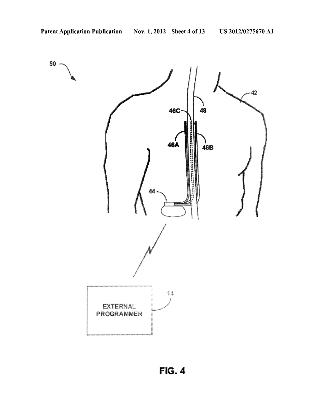 IMAGE-BASED ANALYSIS OF IMPLANTABLE MEDICAL DEVICE POSITIONING - diagram, schematic, and image 05