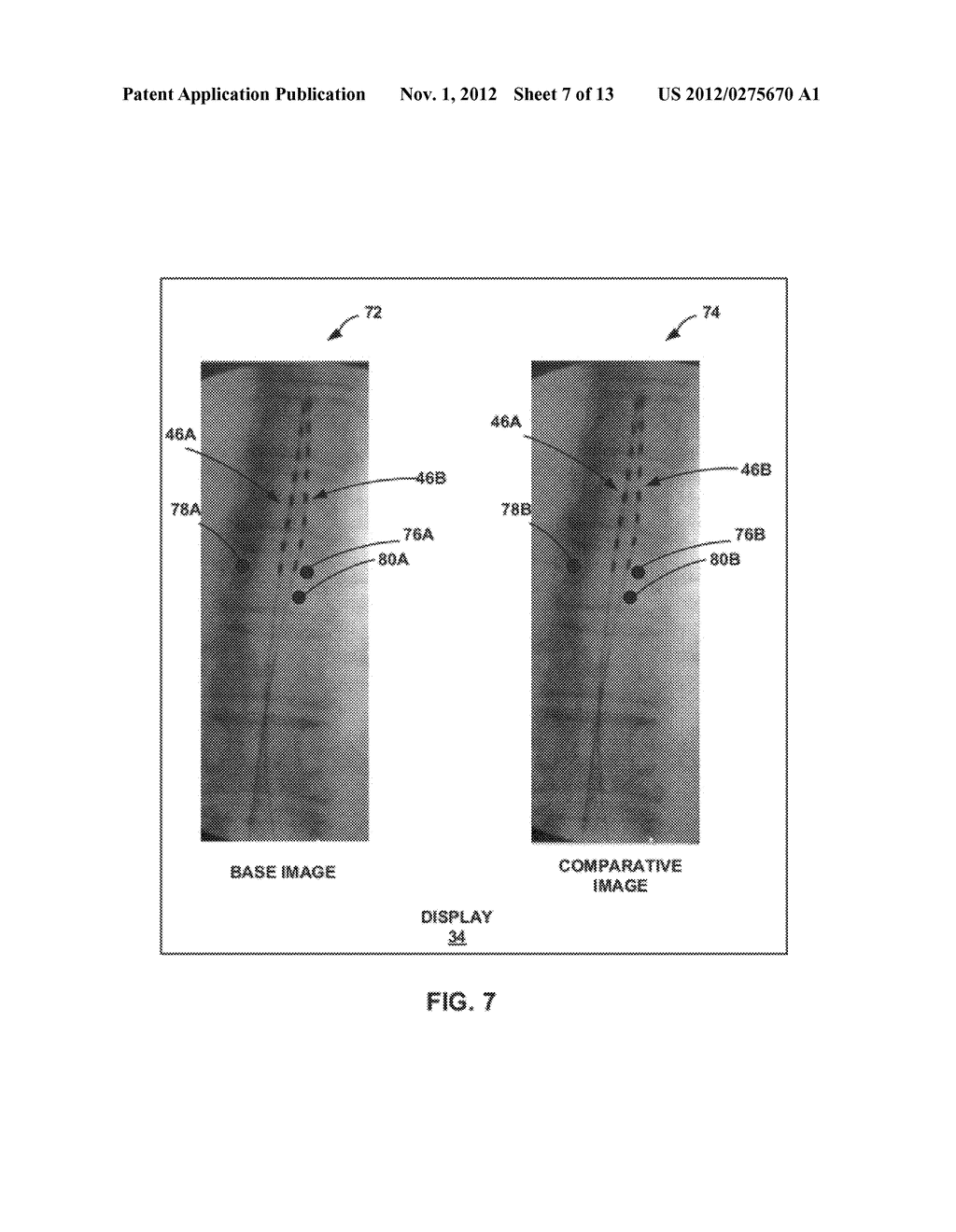 IMAGE-BASED ANALYSIS OF IMPLANTABLE MEDICAL DEVICE POSITIONING - diagram, schematic, and image 08