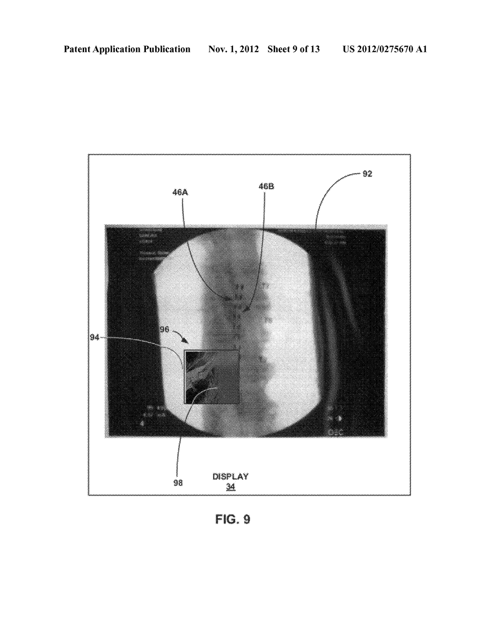 IMAGE-BASED ANALYSIS OF IMPLANTABLE MEDICAL DEVICE POSITIONING - diagram, schematic, and image 10