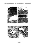 TRANSGENE DELIVERING RETROVIRUS TARGETING COLLAGEN EXPOSED AT SITE OF     TISSUE INJURY diagram and image