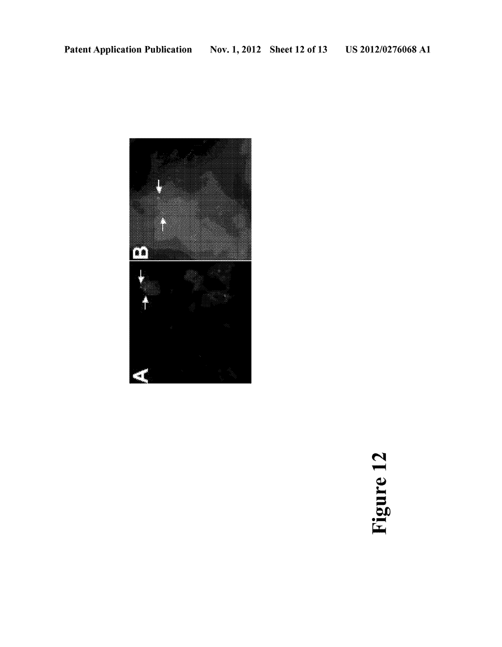 METHOD FOR TREATING CHRONIC NERVE TISSUE INJURY USING A CELL THERAPY     STRATEGY - diagram, schematic, and image 13