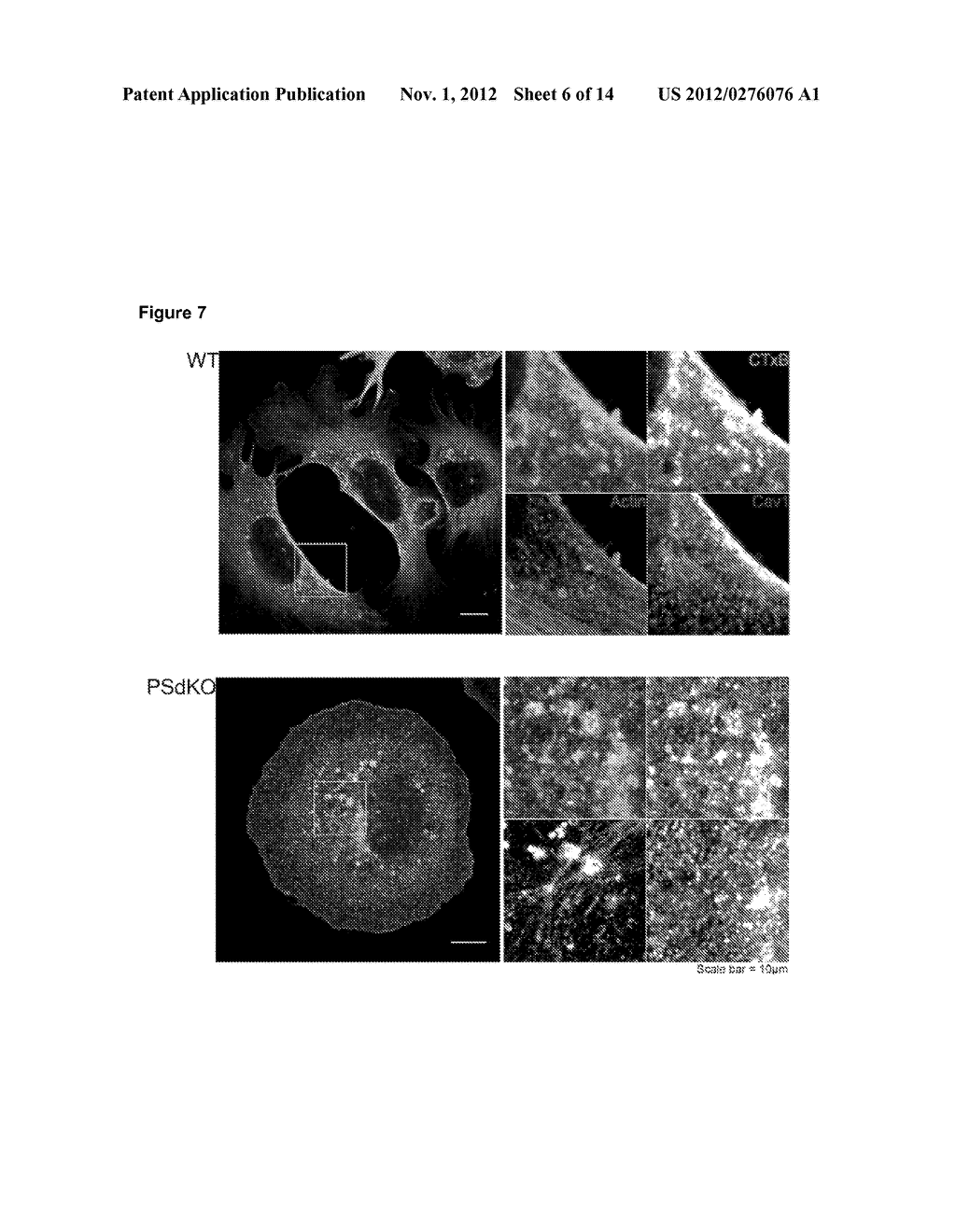 ARF6 AS A NEW TARGET FOR TREATING ALZHEIMER'S DISEASE - diagram, schematic, and image 07