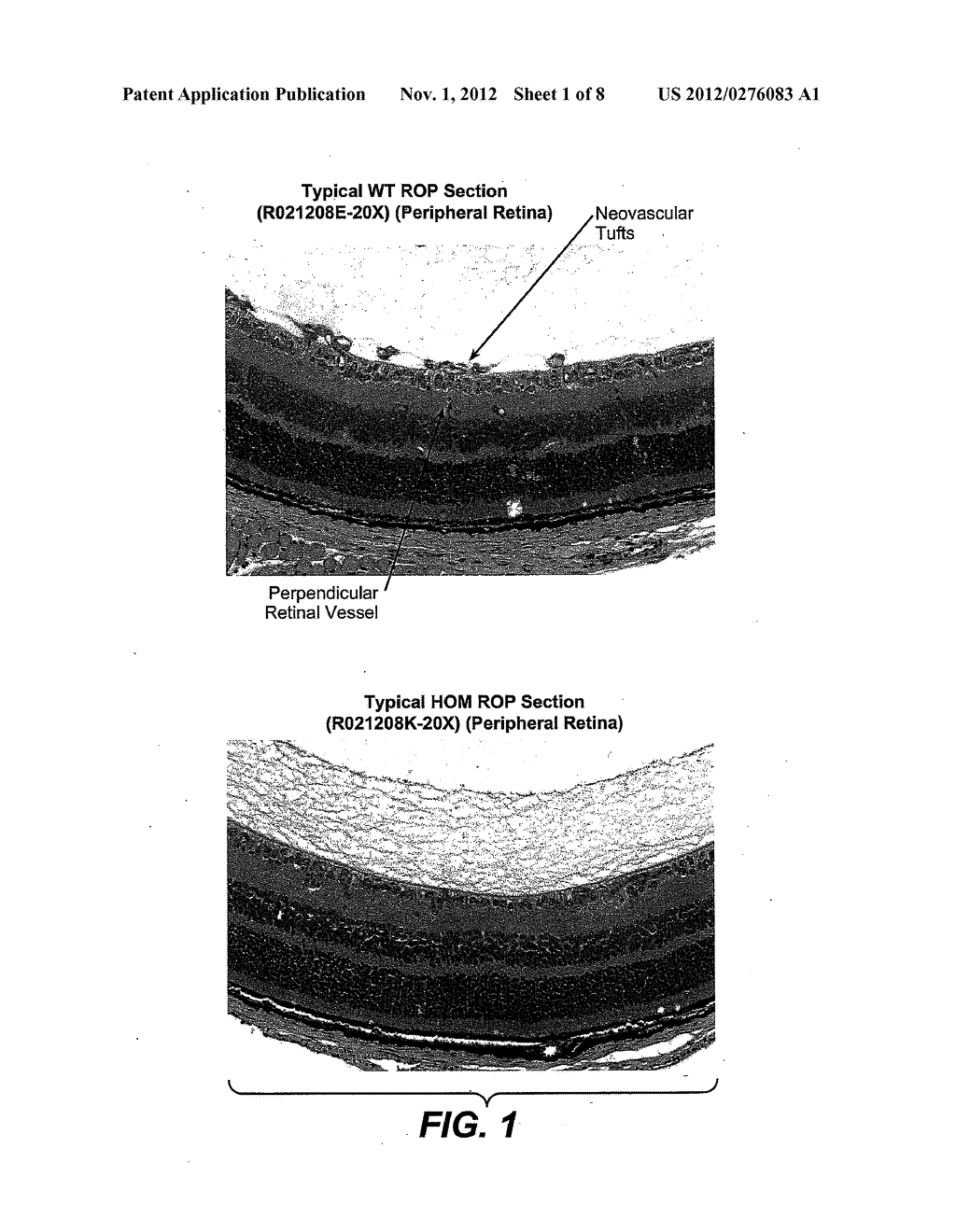 METHODS FOR INHIBITING OCULAR ANGIOGENESIS - diagram, schematic, and image 02