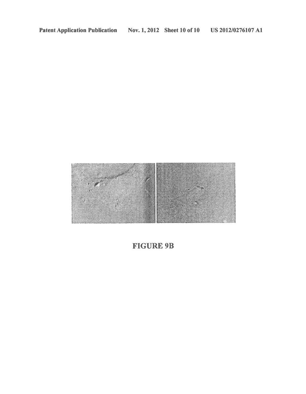 Methods and Compositions for Mycoplasma Pneumoniae Exotoxins - diagram, schematic, and image 11