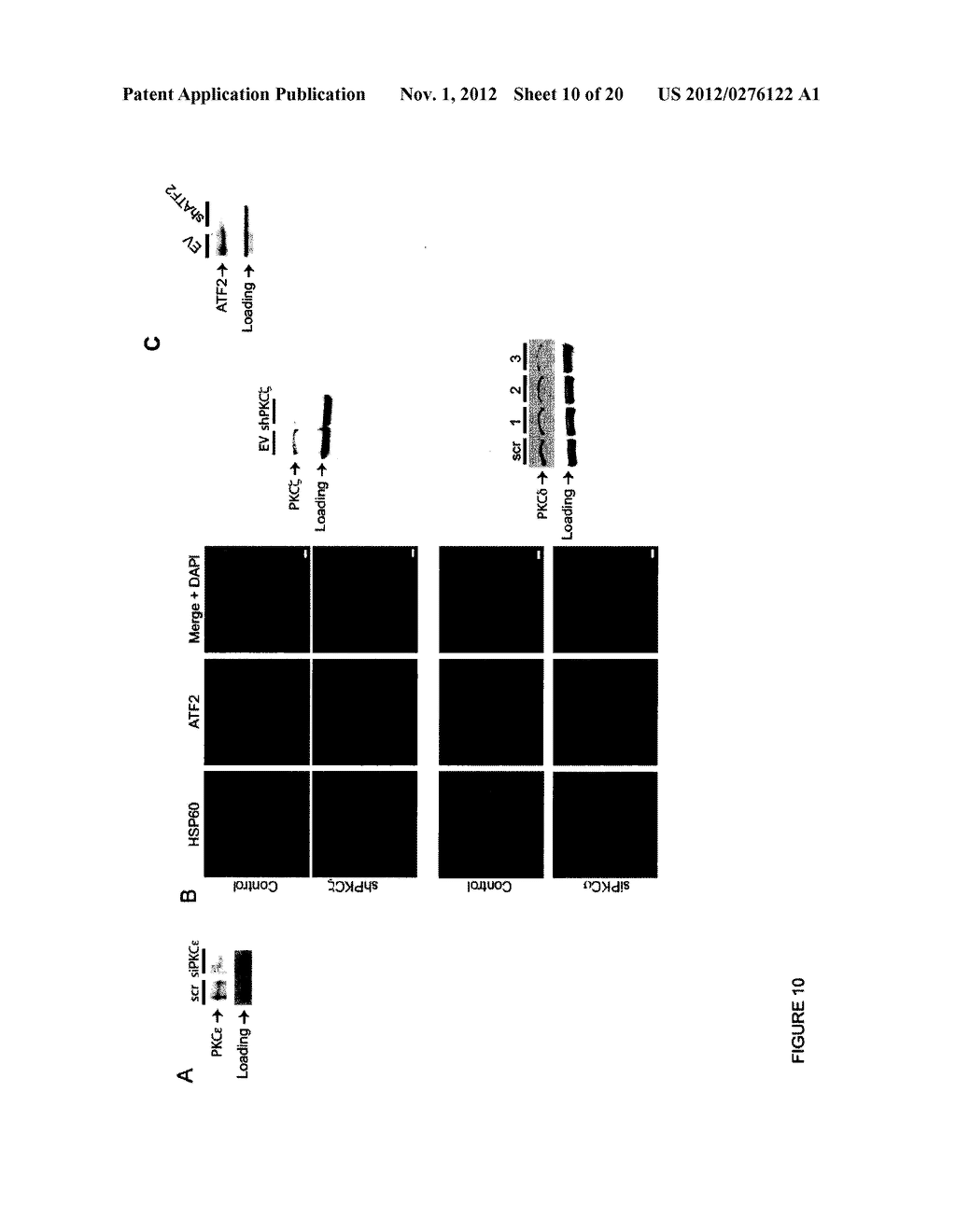 METHODS FOR DIAGNOSIS AND TREATMENT OF CELLULAR PROLIFERATIVE DISORDERS - diagram, schematic, and image 11