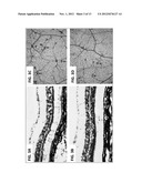 TREATMENT OF RETINAL DISORDERS WITH RECOMBINANT T CELL RECEPTOR LIGAND     (RTL) diagram and image