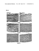 TREATMENT OF RETINAL DISORDERS WITH RECOMBINANT T CELL RECEPTOR LIGAND     (RTL) diagram and image