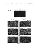 TREATMENT OF RETINAL DISORDERS WITH RECOMBINANT T CELL RECEPTOR LIGAND     (RTL) diagram and image