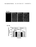 TREATMENT OF RETINAL DISORDERS WITH RECOMBINANT T CELL RECEPTOR LIGAND     (RTL) diagram and image