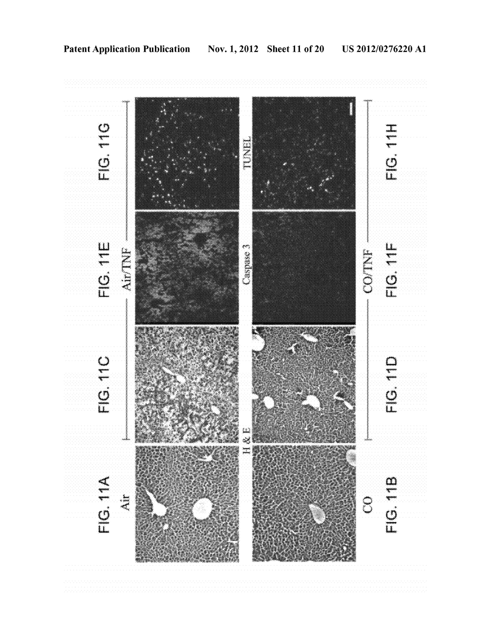 Method of Treating Hepatitis - diagram, schematic, and image 12