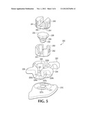 Rotating Orthodontic Bracket with Locking Mechanism diagram and image