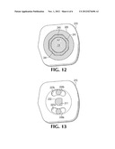 Rotating Orthodontic Bracket with Locking Mechanism diagram and image