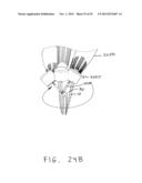 APPARATUS AND METHODS FOR ROOT CANAL TREATMENTS diagram and image