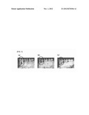 Periodontal Disease Marker diagram and image