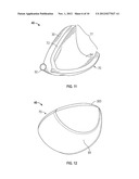 GOLF CLUB HEAD WITH COMPOSITE WEIGHT PORT diagram and image