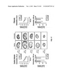 TREATING LIVER DISEASES diagram and image