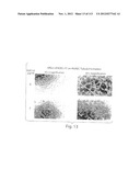 POLYPEPTIDE COMPOUNDS FOR INHIBITING ANGIOGENESIS AND TUMOR GROWTH diagram and image