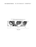 POLYPEPTIDE COMPOUNDS FOR INHIBITING ANGIOGENESIS AND TUMOR GROWTH diagram and image