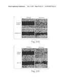 POLYPEPTIDE COMPOUNDS FOR INHIBITING ANGIOGENESIS AND TUMOR GROWTH diagram and image