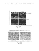 POLYPEPTIDE COMPOUNDS FOR INHIBITING ANGIOGENESIS AND TUMOR GROWTH diagram and image