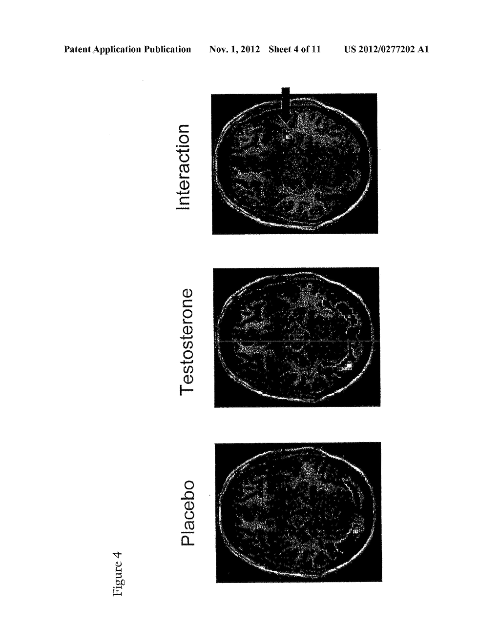 CONTROLLED RELEASE DELIVERY SYSTEM FOR NASAL APPLICATIONS AND METHODS OF     TREATMENT - diagram, schematic, and image 05