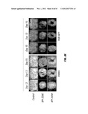 ANALOGS OF DEHYDROPHENYLAHISTINS AND THEIR THERAPEUTIC USE diagram and image