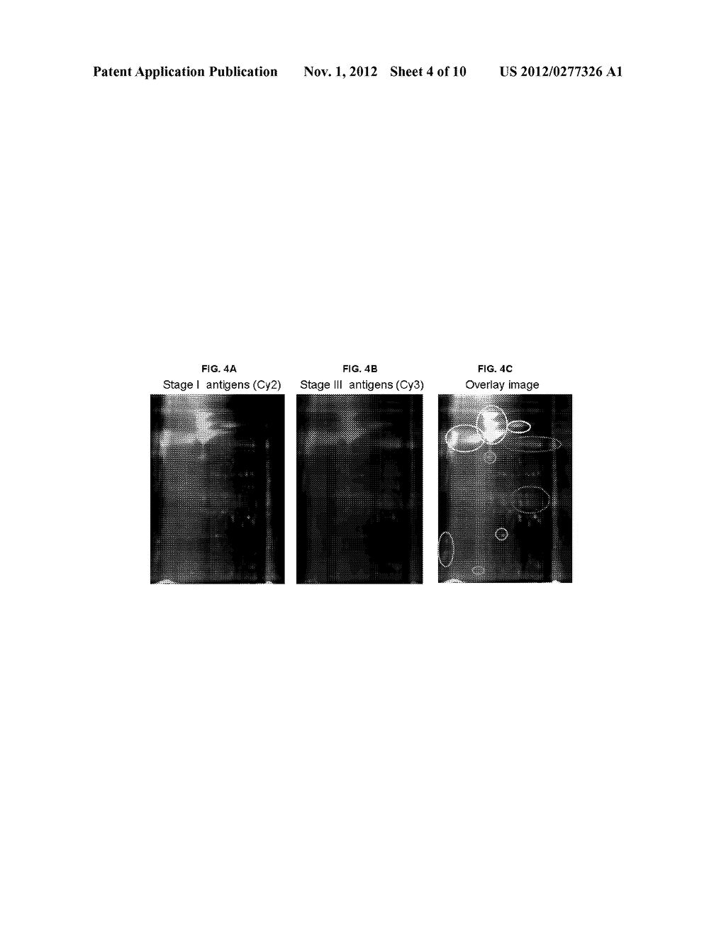 BIOMARKERS OF CANCER - diagram, schematic, and image 05