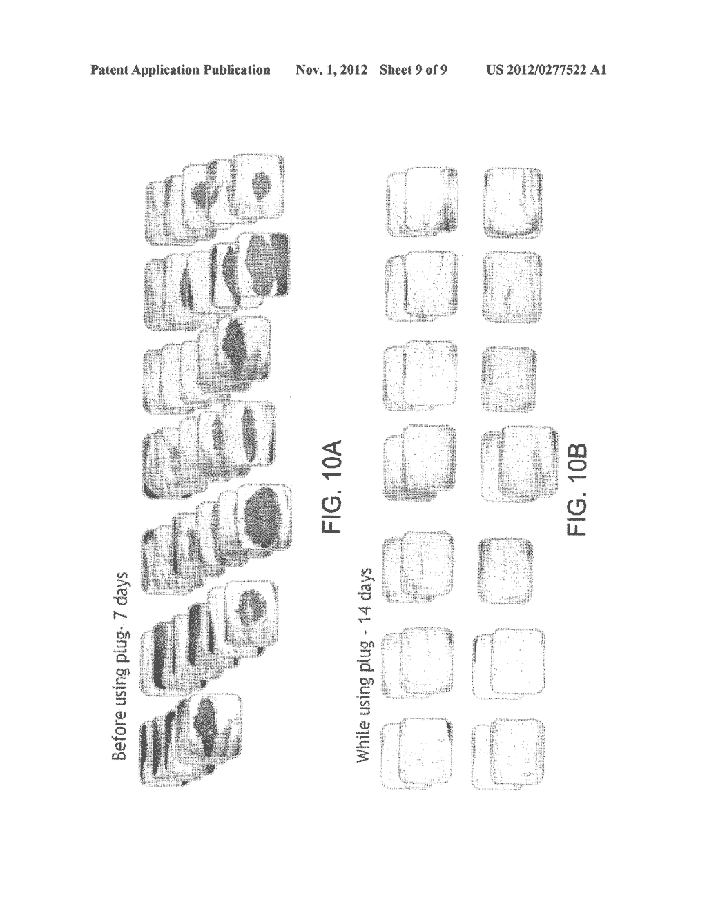 FECAL INCONTINENCE DEVICE, SYSTEM AND METHOD - diagram, schematic, and image 10