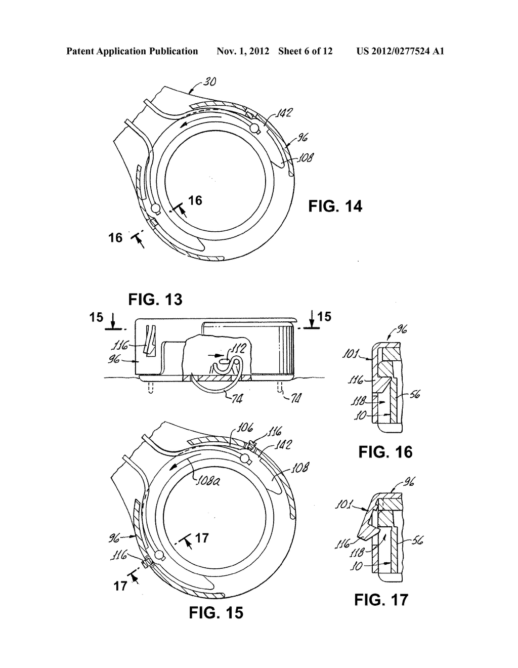IMPLANTABLE ACCESS PORT DEVICE HAVING A SAFETY CAP - diagram, schematic, and image 07