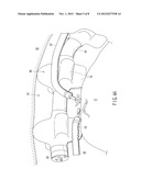 BODY INSERTION INSTRUMENT diagram and image