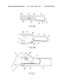 BODY INSERTION INSTRUMENT diagram and image