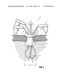 Triangulation Concept for Minimally Invasive Access Surgery diagram and image