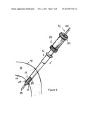 TWO-PIECE CANNULA, A KIT COMPRISING A TWO-PIECE CANNULA AND AN INSERTER diagram and image