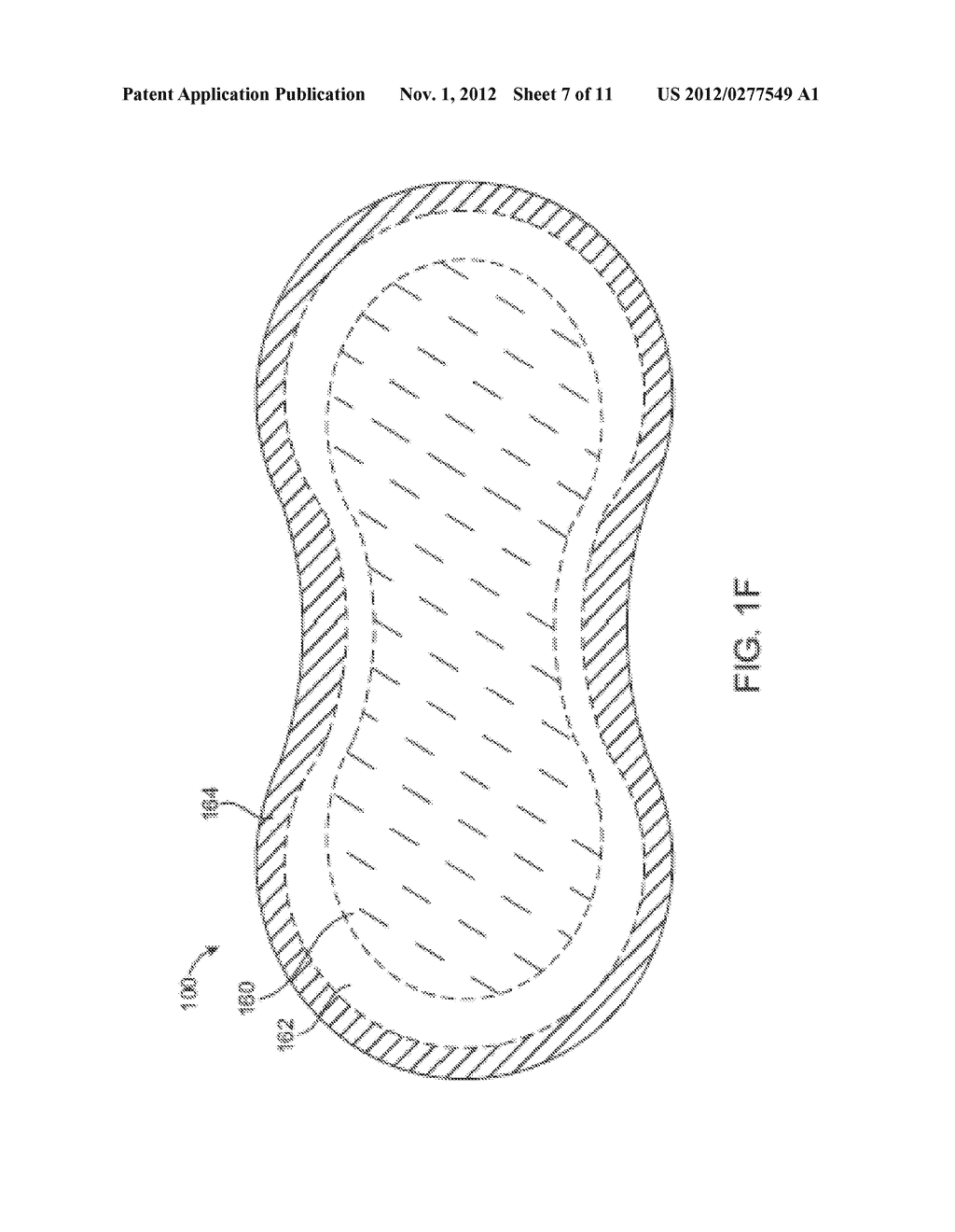 ADHERENT DEVICE FOR SLEEP DISORDERED BREATHING - diagram, schematic, and image 08