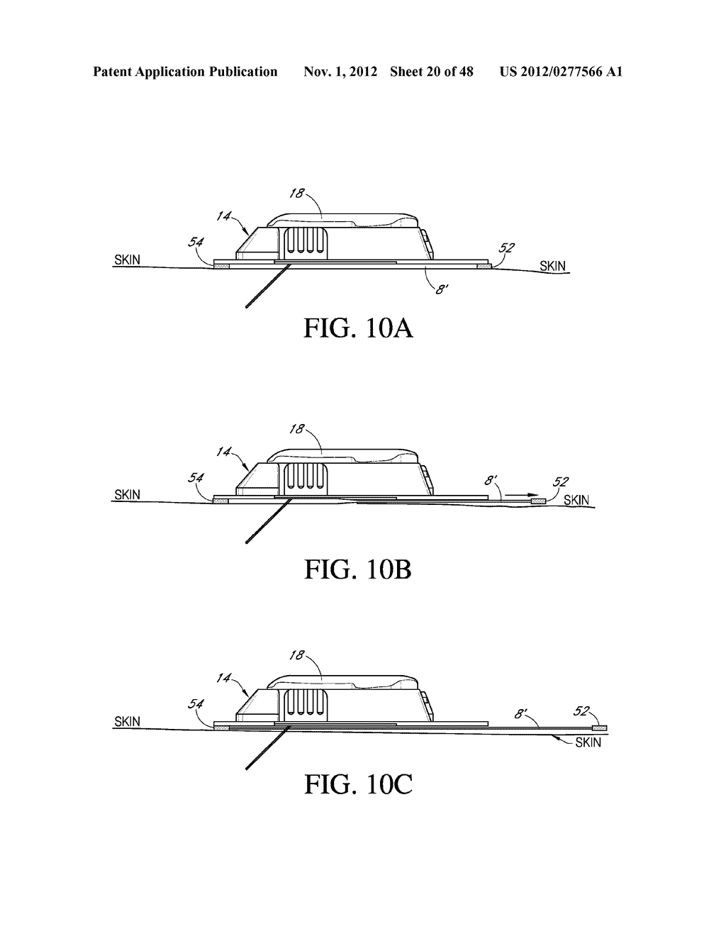 SYSTEM AND METHODS FOR PROCESSING ANALYTE SENSOR DATA FOR SENSOR     CALIBRATION - diagram, schematic, and image 21