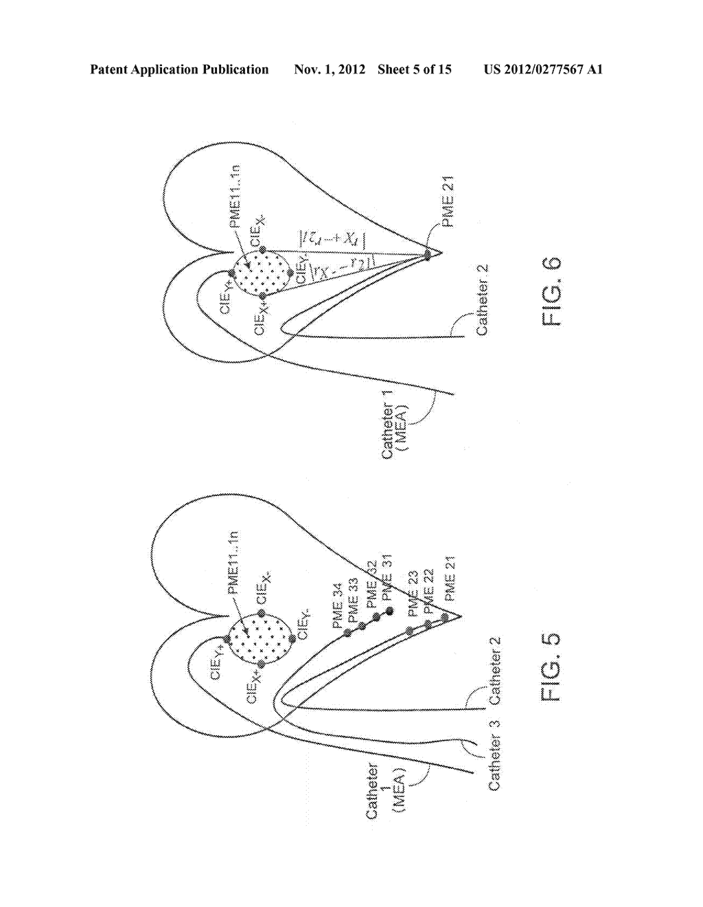 INTRA-CARDIAC TRACKING SYSTEM - diagram, schematic, and image 06