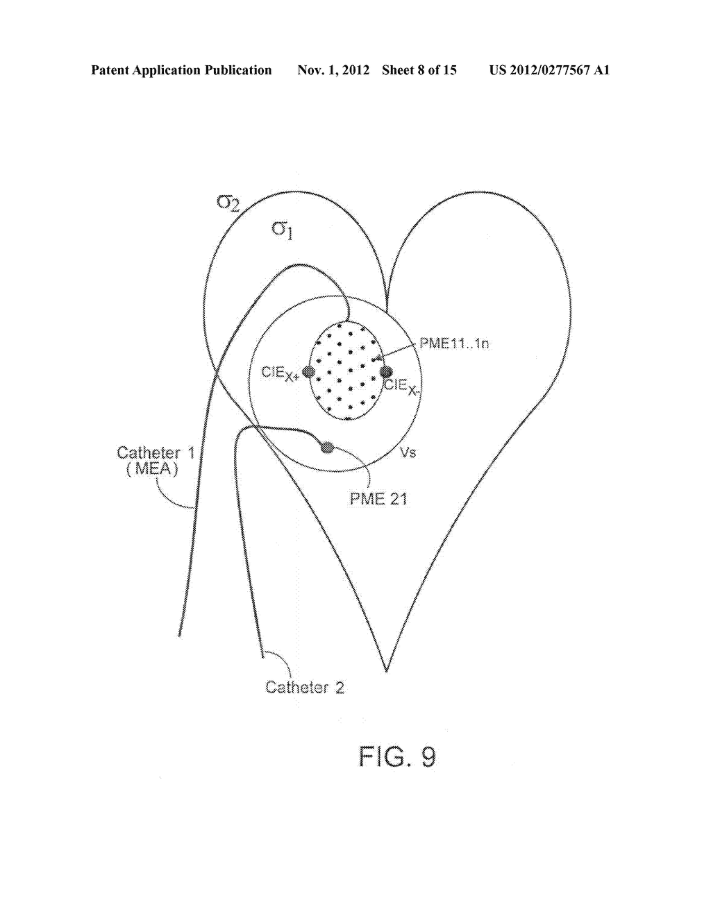 INTRA-CARDIAC TRACKING SYSTEM - diagram, schematic, and image 09