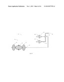 Balloon Resection Method diagram and image