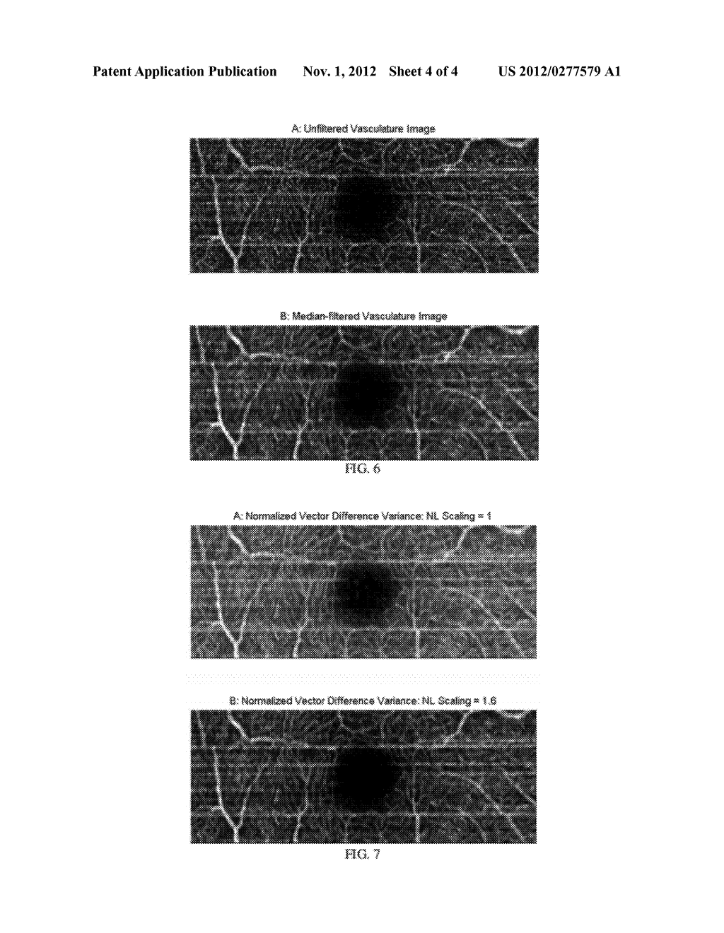 INTER-FRAME COMPLEX OCT DATA ANALYSIS TECHNIQUES - diagram, schematic, and image 05