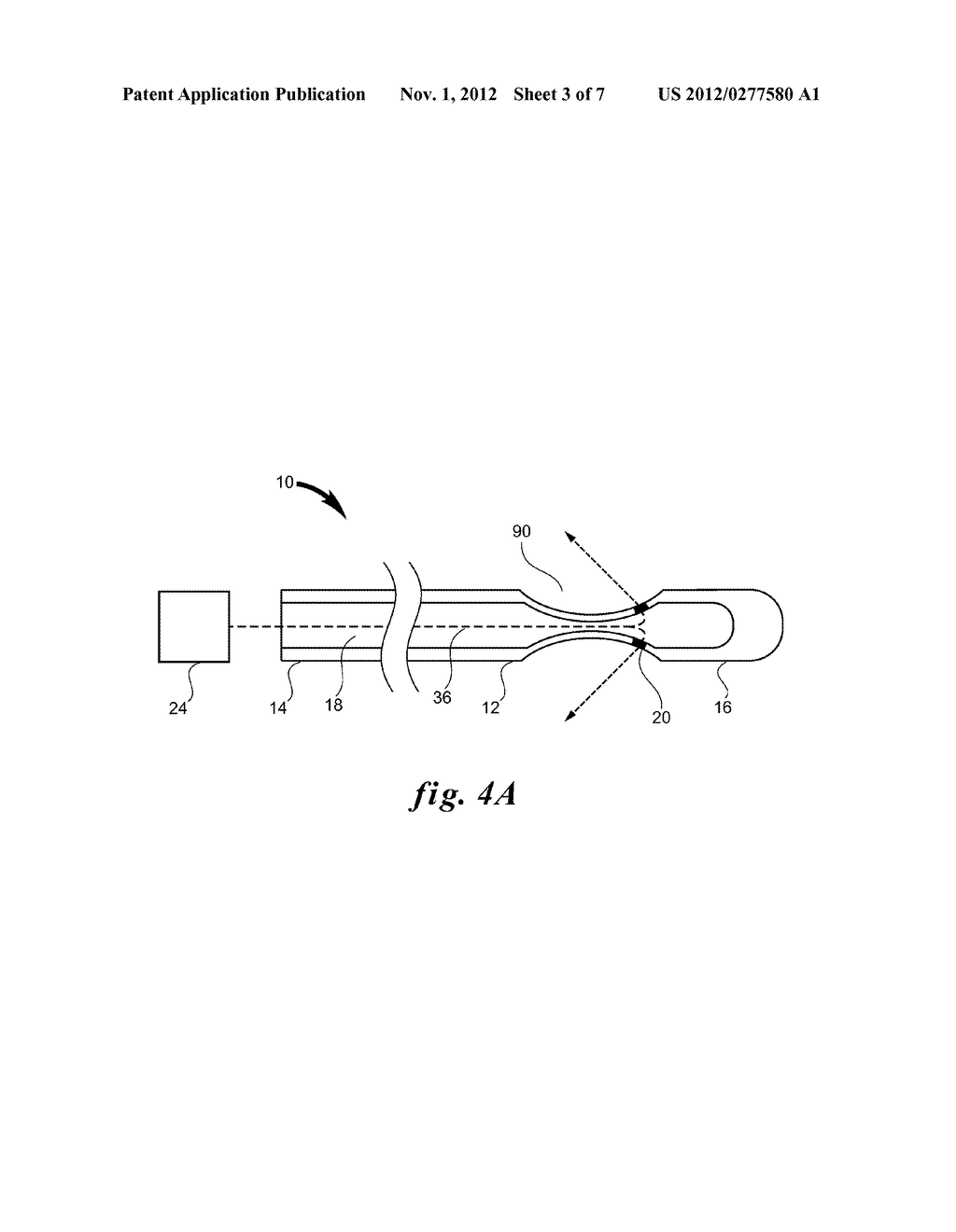 SYSTEM AND METHOD FOR DILUTING BLOOD IN A VESSEL - diagram, schematic, and image 04