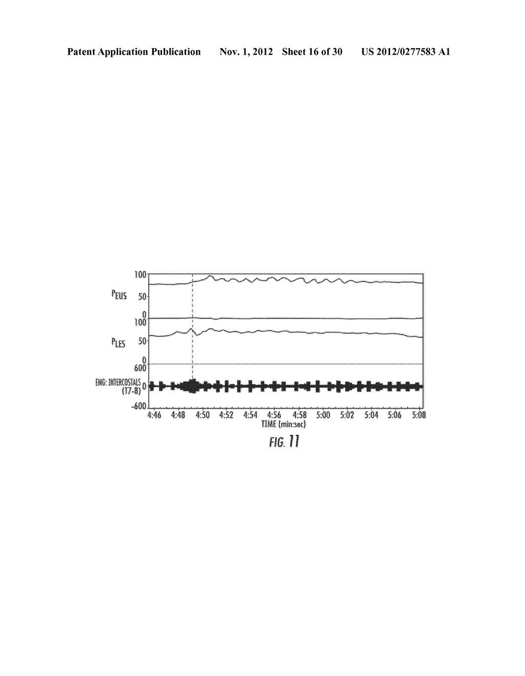 SYSTEM AND METHOD FOR TESTING THE GASTRIC VALVE - diagram, schematic, and image 17