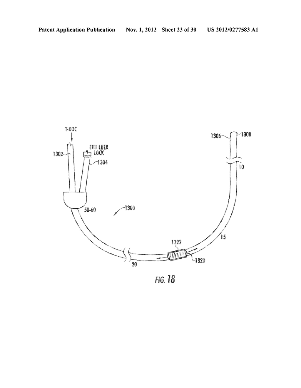 SYSTEM AND METHOD FOR TESTING THE GASTRIC VALVE - diagram, schematic, and image 24