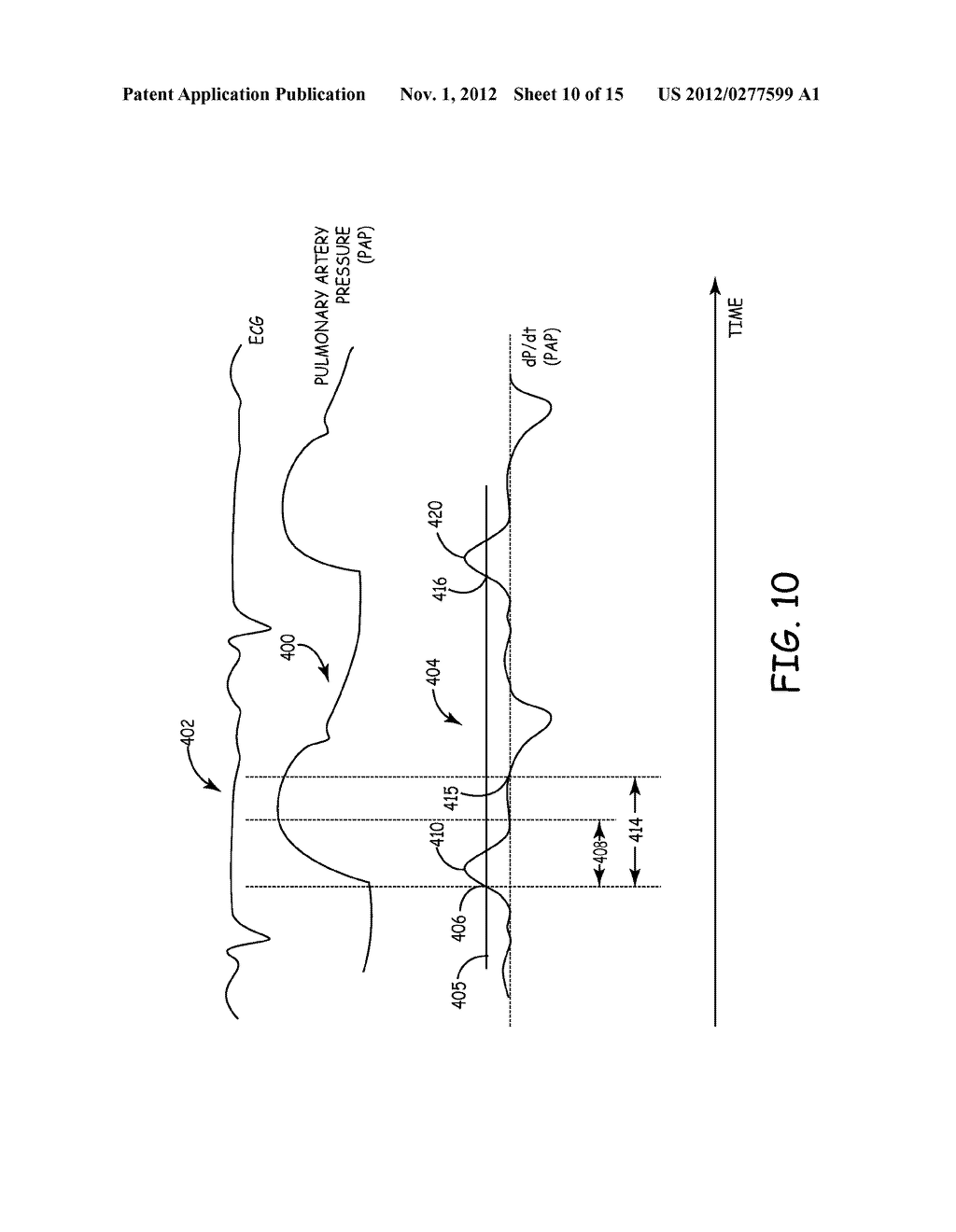 MEASUREMENT OF CARDIAC CYCLE LENGTH AND PRESSURE METRICS FROM PULMONARY     ARTERIAL PRESSURE - diagram, schematic, and image 11
