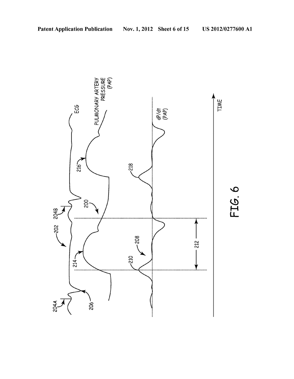 MEASUREMENT OF CARDIAC CYCLE LENGTH AND PRESSURE METRICS FROM PULMONARY     ARTERIAL PRESSURE - diagram, schematic, and image 07