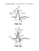 DISTINGUISHING PREMATURE CONTRACTIONS IN A MEDICAL DEVICE diagram and image