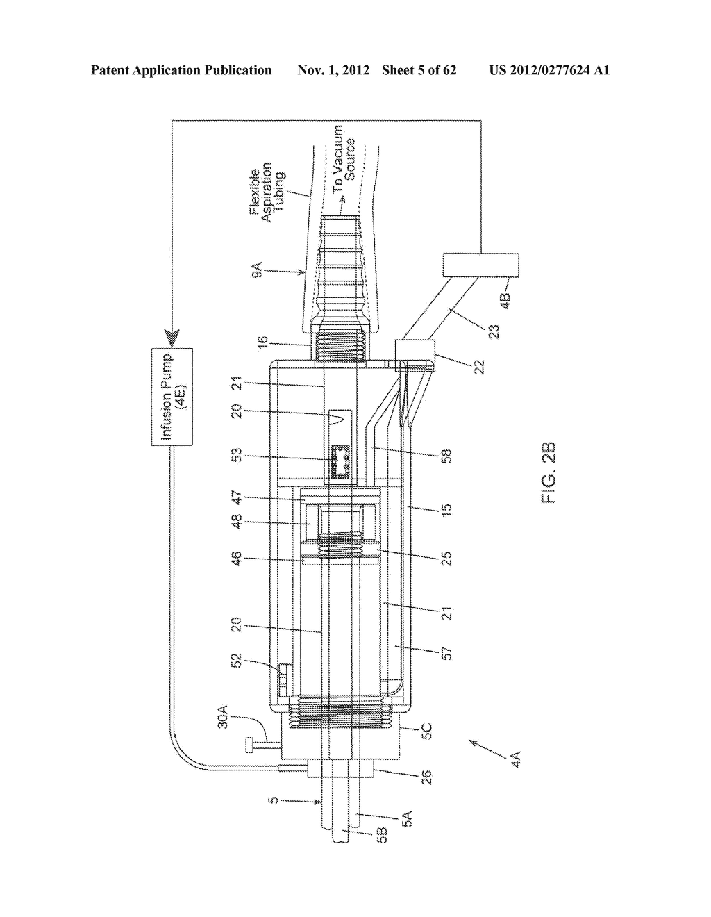 METHOD OF COLLECTING AND IN SITU PROCESSING OF ASPIRATED FAT TISSUE     SAMPLED FROM A HUMAN PATIENT DURING TISSUE ASPIRATION OPERATIONS - diagram, schematic, and image 06